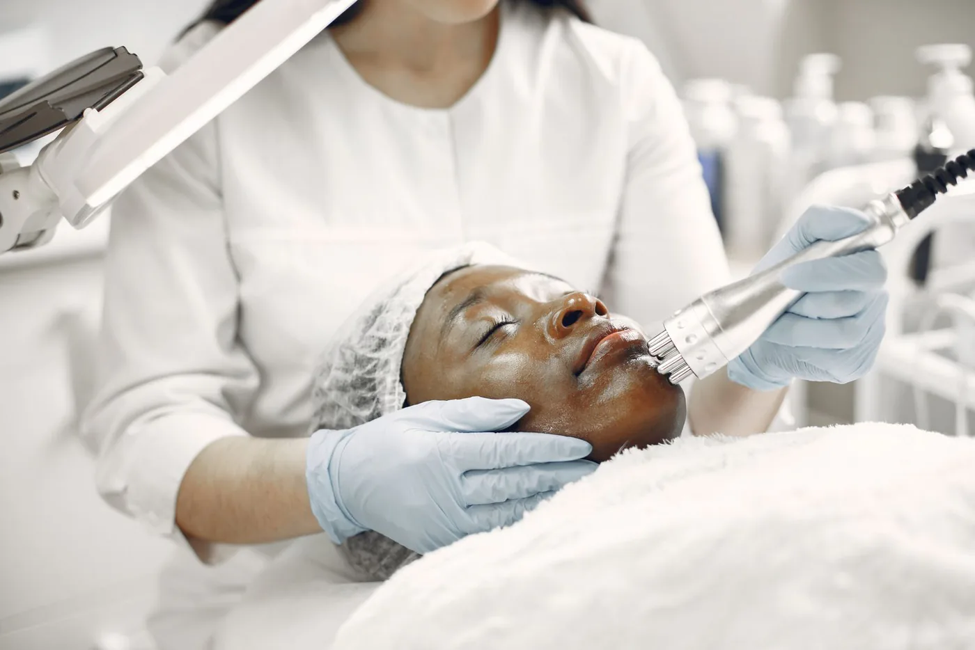 Microneedling & MNRF results