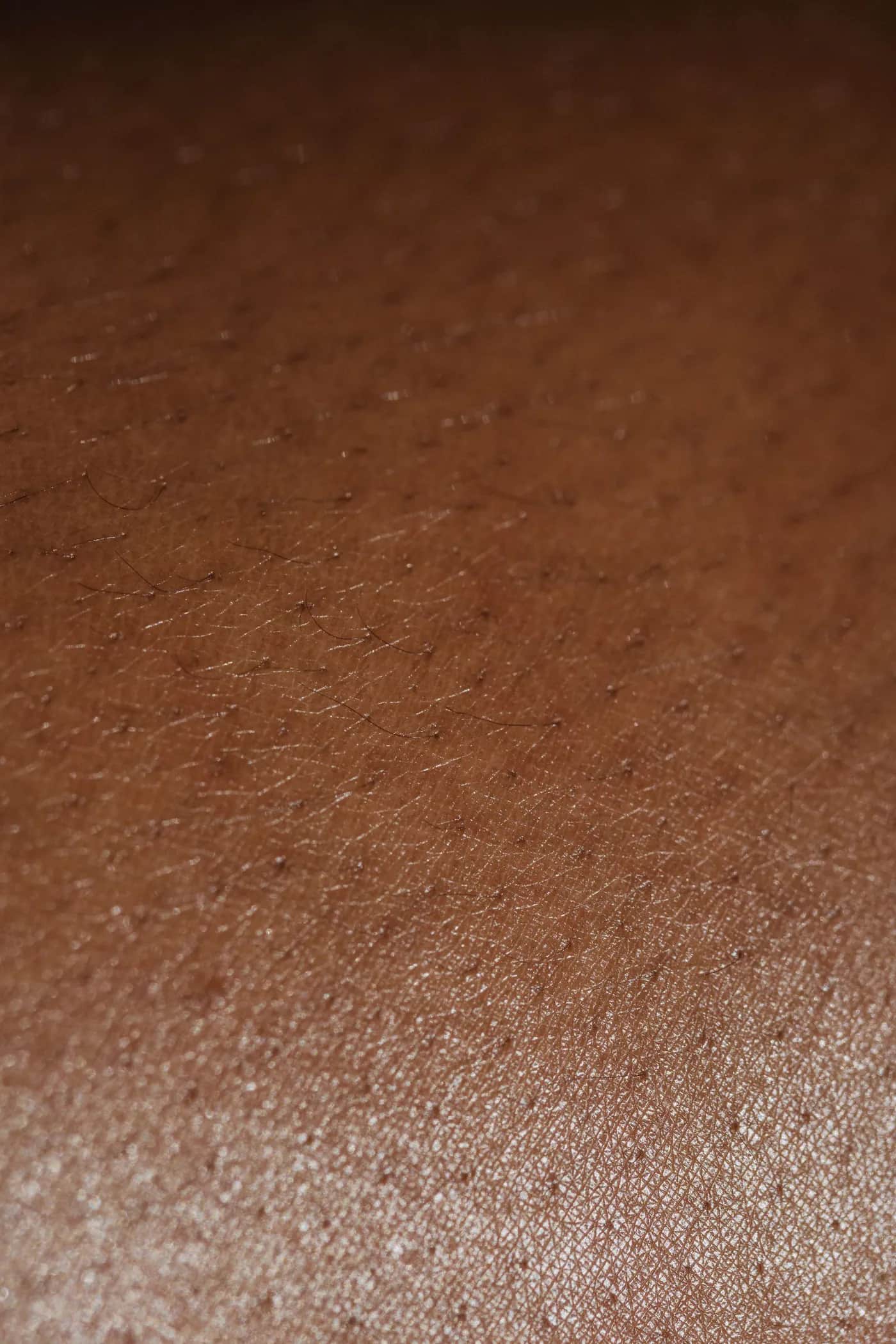 Waxing & Hair Removal