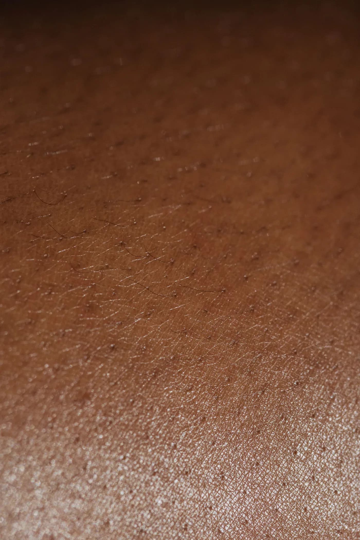 Waxing & Hair Removal